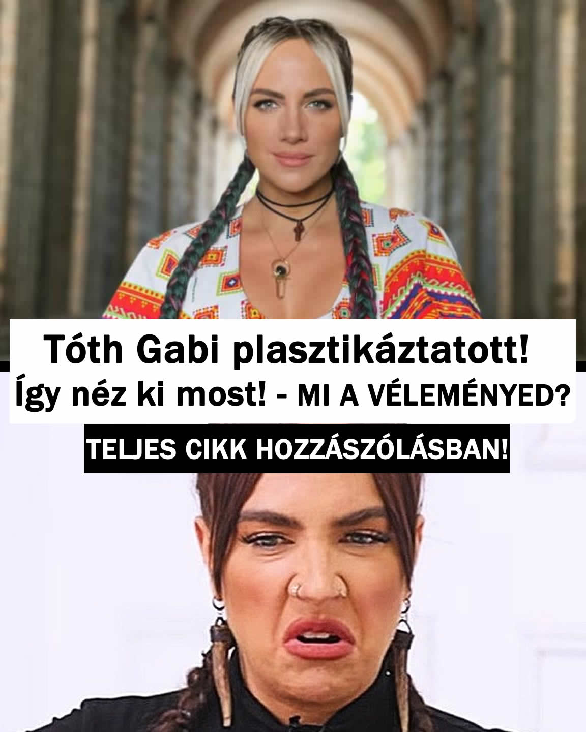 Tóth Gabi plasztikáztatott! Így néz ki most!