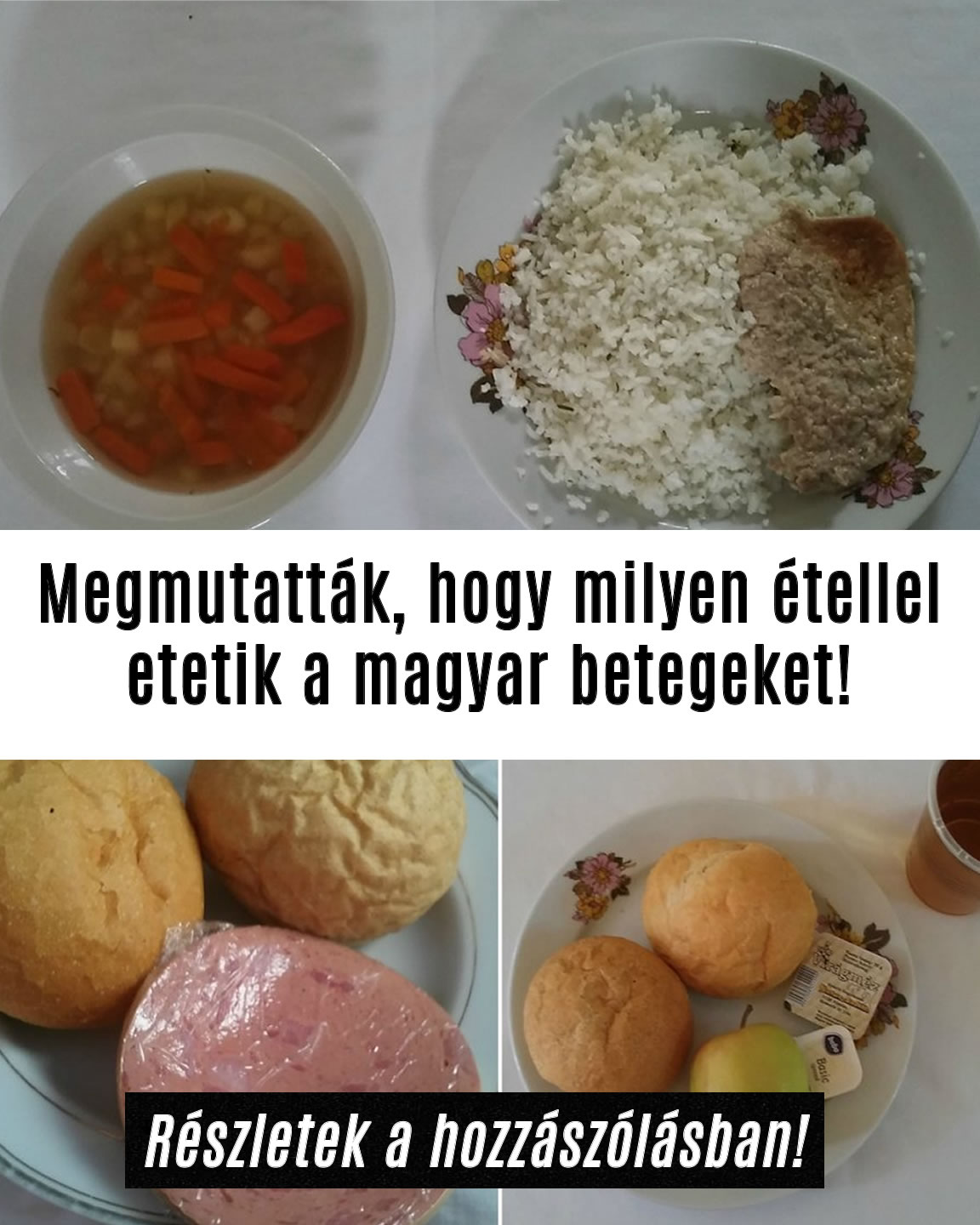 Megmutatták, hogy milyen étellel etetik a magyar betegeket!