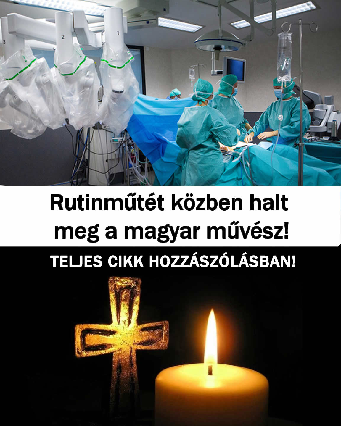 Rutinműtét közben halt meg a magyar művész!