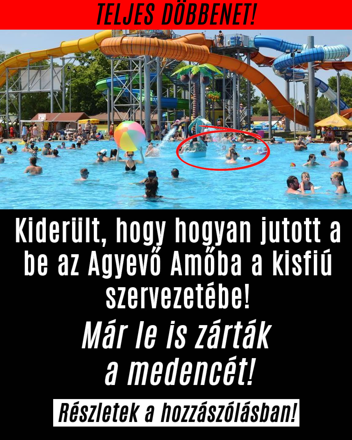 Kiderült hogy jutott a be az Agyevő Amőba a kisfiúba!