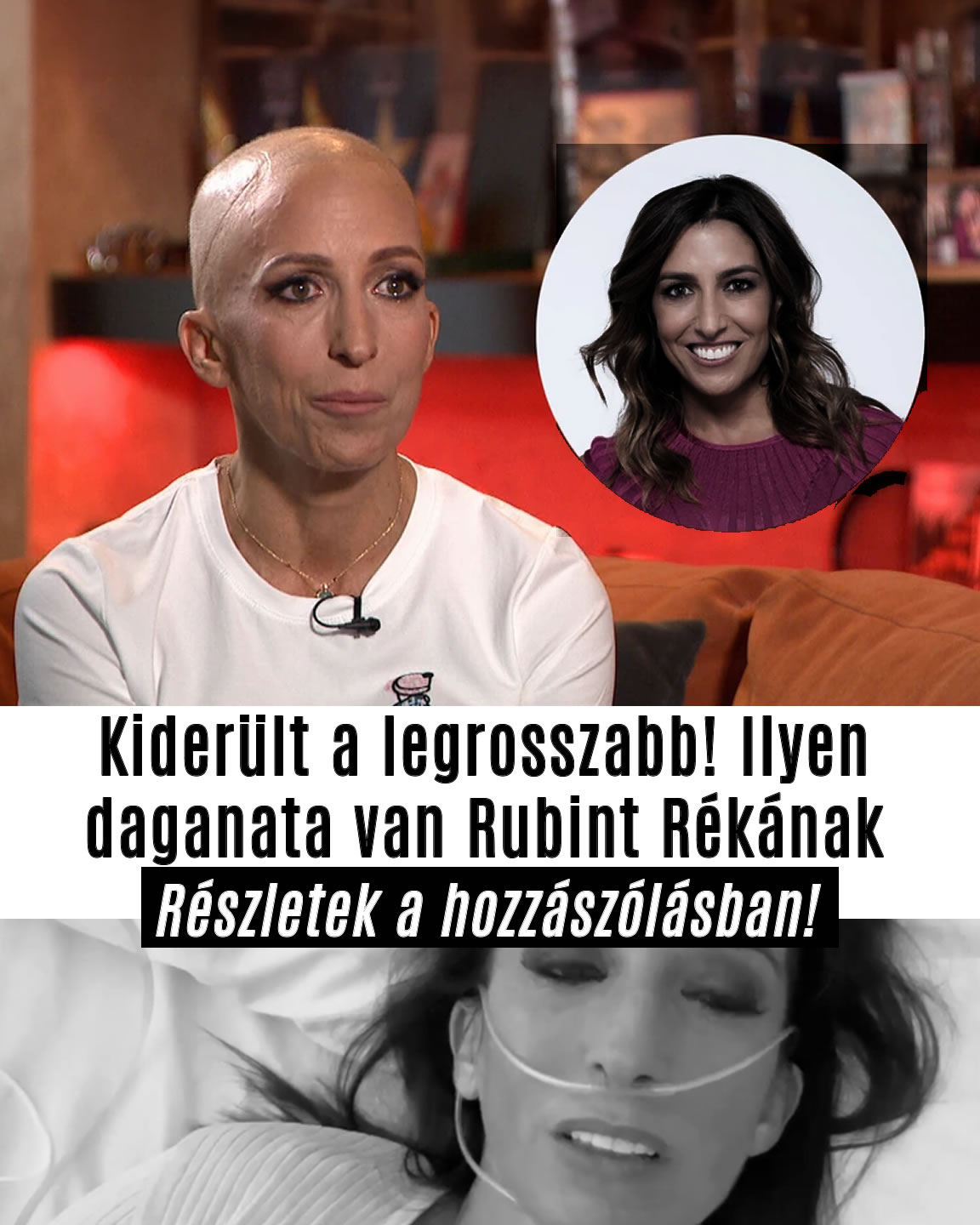 Ilyen daganata van Rubint Rékának