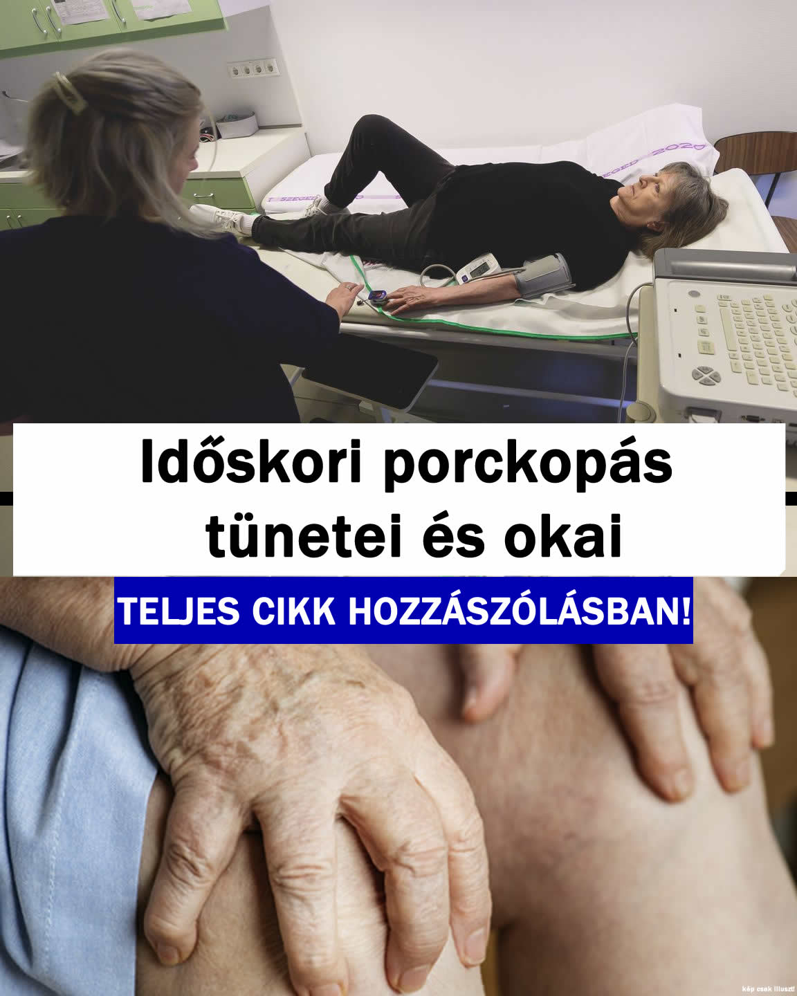 Időskori porckopás tünetei és okai