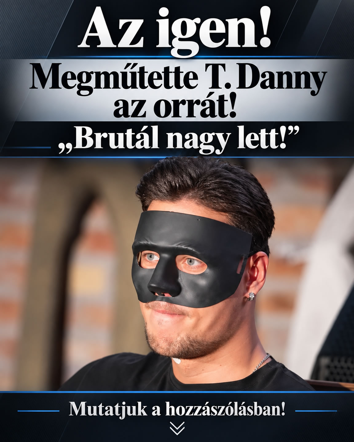 Megműtette T. Danny az orrát!