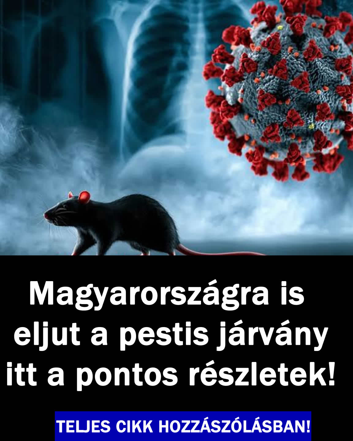 Magyarországra is eljut a pestis
